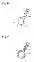 Fig. 16 - BODY LUMEN OCCLUSION APPARATUS AND METHODS