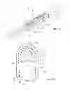 Fig. 02 - Soft tissue repair device and associated methods