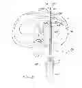 Fig. 14 - Soft tissue repair device and associated methods