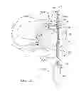 Fig. 15 - Soft tissue repair device and associated methods
