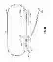 Fig. 20 - Soft tissue repair device and associated methods