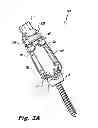 Fig. 04 - Rod reduction device