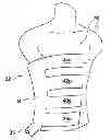 Fig. 01 - Patient Heat Transfer Device