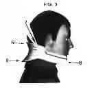 Fig. 04 - Sleepy heads neck pillow