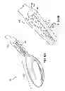 Fig. 06 - Chinese soup spoon