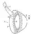 Fig. 08 - Chinese soup spoon