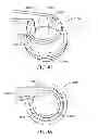 Fig. 49 - DRY POWDER INHALER ASSEMBLY AND CONTAINERS