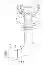 Fig. 02 - TRACHEAL TUBE HAVING A FLANGE WITH A VARIABLE VOLUME