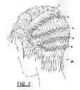 Fig. 02 - Self administrable hair extension system and method