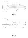 Fig. 02 - Dental Care Device