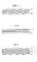 Fig. 02 - Method for manufacturing a metal assembly having a sheet of thermally treated aluminum to obtain alpha alumina and another sheet having surface irregularities that become embedded in said surface during roll bonding