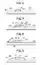 Fig. 04 - Component assembly using a temporary attach material