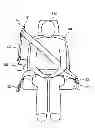 Fig. 01 - Restraint device