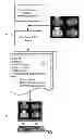 Fig. 01 - Interactive display of computer aided detection results in combination with quantitative prompts