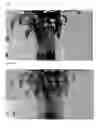 Fig. 02 - Stereo camera system and method for controlling convergence