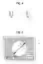 Fig. 04 - Ophthalmic apparatus