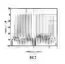 Fig. 08 - Apparatus and method for processing an audio signal using patch border alignment