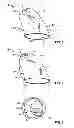 Fig. 02 - Ear tip piece for hearing instruments