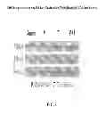 Fig. 08 - Treatment methods utilizing stem cell mobilizers and immunosuppressive agents
