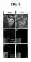 Fig. 09 - COMPOSITIONS AND METHODS FOR TREATMENT OF PARKINSON'S DISEASE