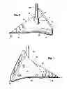 Fig. 03 - DUAL PUPOSE GOLF PUTTER