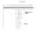 Fig. 02 - MPL mutations in JAK2 V617F negative patients with myeloproliferative disease