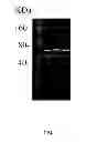 Fig. 02 - Fertilization prediction and promotion