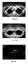 Fig. 07 - Method and system for design of spectral filter to classify tissue and material from multi-energy images