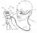 Fig. 01 - Methods and systems for treating meibomian gland dysfunction using radio-frequency energy