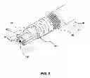 Fig. 03 - Adjustable variable stiffness transluminal device