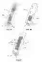 Fig. 04 - Adjustable variable stiffness transluminal device