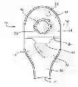 Fig. 01 - Ostomy devices