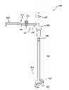 Fig. 01 - PRECISE FEMORAL COMPONENT POSITIONING FOR HIP REPLACEMENT SURGERY