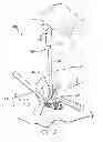 Fig. 06 - PRECISE FEMORAL COMPONENT POSITIONING FOR HIP REPLACEMENT SURGERY