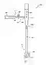 Fig. 07 - PRECISE FEMORAL COMPONENT POSITIONING FOR HIP REPLACEMENT SURGERY