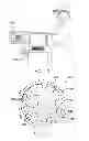 Fig. 09 - PRECISE FEMORAL COMPONENT POSITIONING FOR HIP REPLACEMENT SURGERY