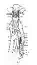 Fig. 02 - Retention system for an endoluminal device