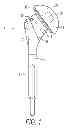 Fig. 02 - Shoulder prosthesis