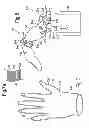 Fig. 06 - Prosthetic apparatus and artificial joint