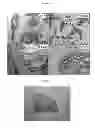 Fig. 09 - Hormone responsive tissue culture system and uses thereof