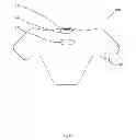 Fig. 07 - Facial cover