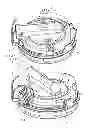 Fig. 01 - Method and fastening device for fastening an assembly in an opening of a wall of a vehicle