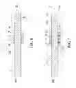 Fig. 07 - Ball screw with sectional circulating assemblies