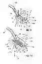 Fig. 08 - Archery Bow Cable Guard