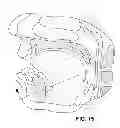 Fig. 09 - Sling-based treatment of obstructive sleep apnea