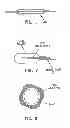 Fig. 02 - Balloon folding technology