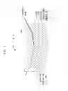 Fig. 04 - Image processing apparatus and image processing method