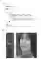 Fig. 14 - Image processing system and display device for carrying out subtraction or addition of a pixel value of a target pixel in accordance with a value equivalent to a noise quantity