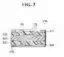 Fig. 04 - Dynamic microphone unit and dynamic microphone