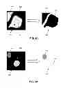 Fig. 03 - Image processing system providing selective arrangement and configuration for an image analysis sequence